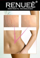 Renuee 2f�r1 gegen Schwangerschaftsstreifen und schlaffe Haut!!