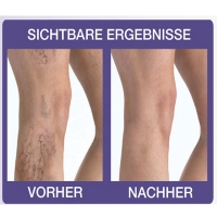 Velform Perfect Legs die effizient L�sung gegen Krampfadern!