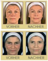 Sedicina Hautcreme mit Seidenextrakt