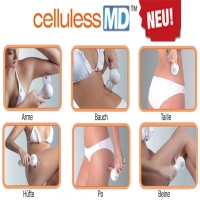 Celluless MD neuste Technologie gegen Cellulite