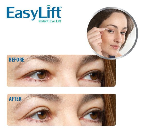Easy Lift - Augenlidstrips sofort jünger aussehen