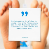 IZA Effect Spray anti-mycoses des pieds et des ongles 1+1 gratuit